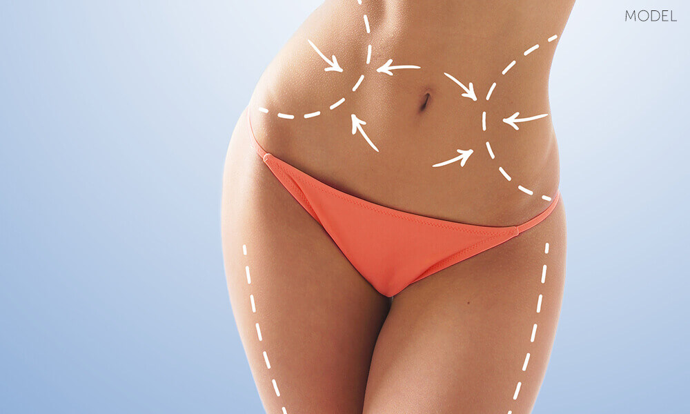 Read Article: Mini Tummy Tuck vs. Full Tummy Tuck: Which Procedure Is Right for Me?